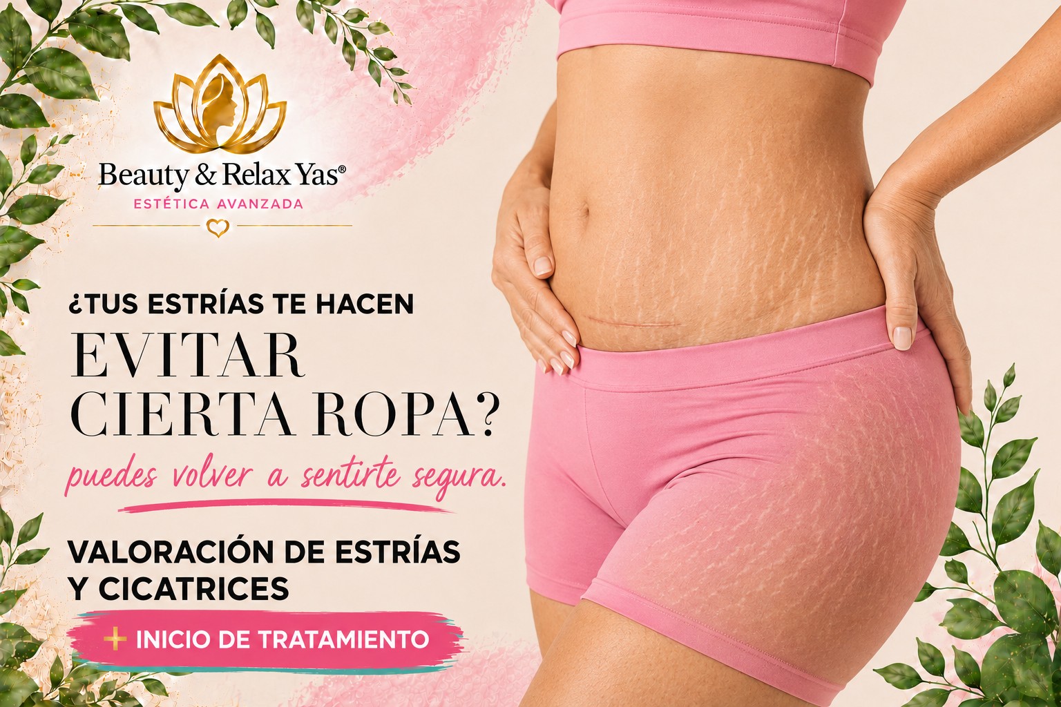 Estrías / cicatrices