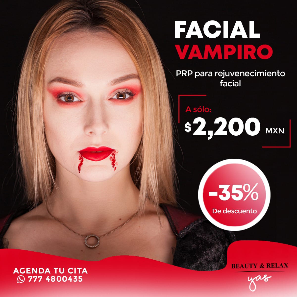 Facial Vampiro (Rejuvenecimiento)